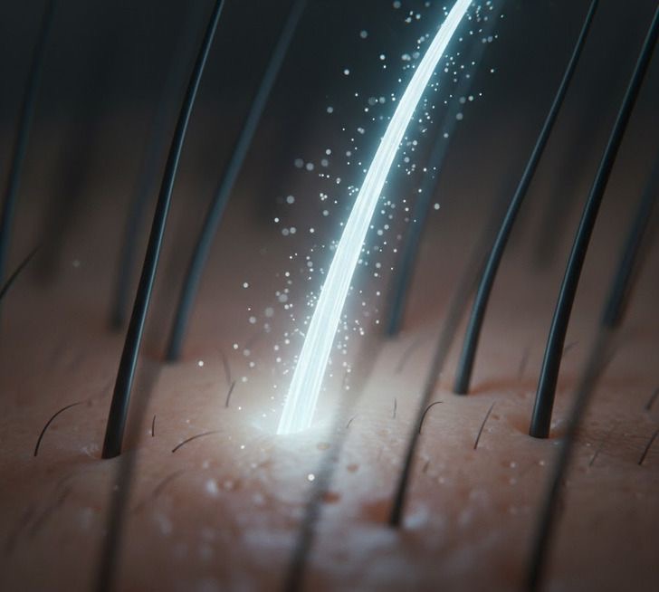 Laser Erbium